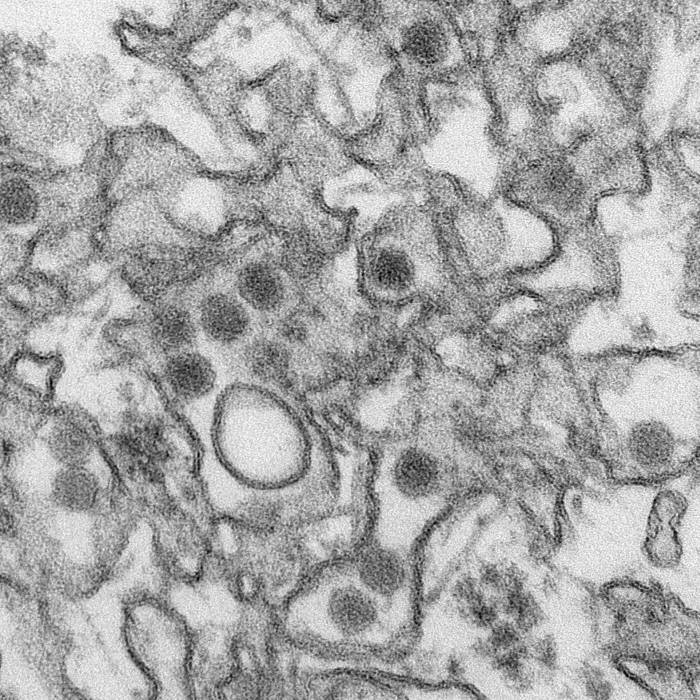 지카 바이러스의 전자 현미경 사진. 바이러스 지름이 40nm, 외부에는 막이 있고, 내부에는 짙은 핵이 있다(출처: CDC).