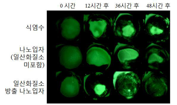 시간 경과에 따른 일산화질소 전달 나노입자의 각막 치유 효과.