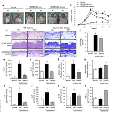 집먼지 진드기와 합텐으로 유도한 아토피성 피부염 모델에서 다이에콜 도포를 통한 아토피성 피부염개선효과