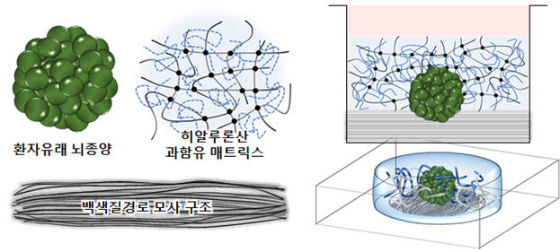 환자 대체치료용 3차원 체외뇌암모델의 모식도