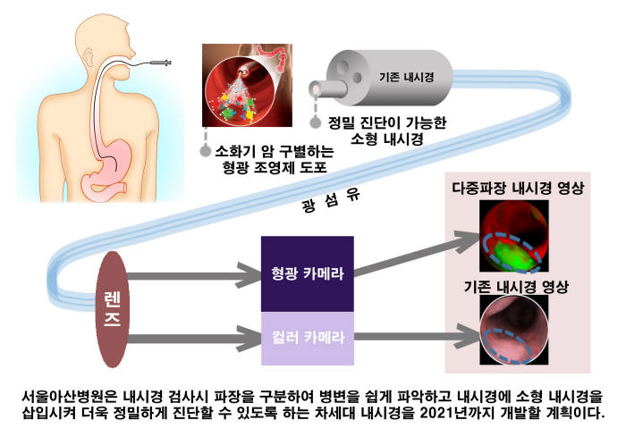 차세대 내시경 인포그래픽