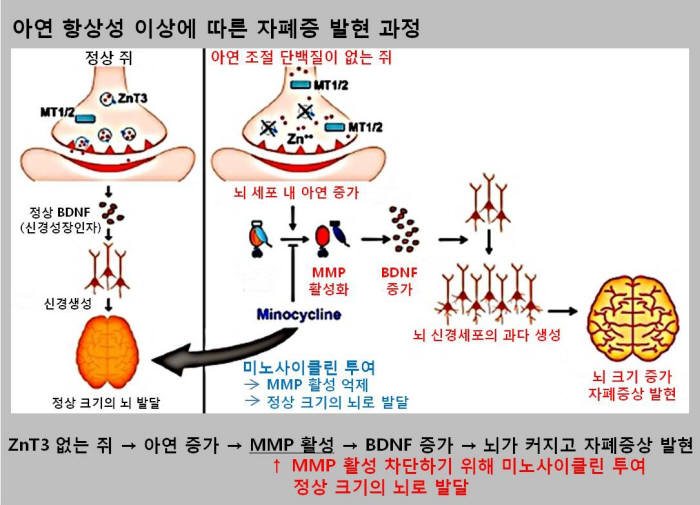 아연 항상성 이상에 따른 자폐증 발현 과정