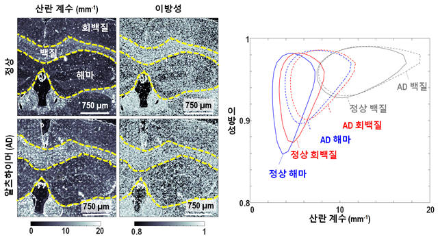 정상모델과 알츠하이머병 모델의 뇌 조직 산란 계수 이방성 분포