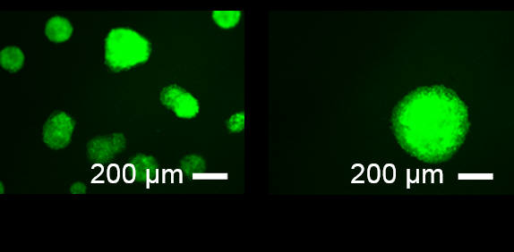 페트리디쉬에서 형성된 유도만능줄기세포의 세포군체와(왼쪽) 수직형 실리콘 나노기둥 구조에서 형성된 유도만능줄기세포의 세포군체(오른쪽) 모습(형광촬영사진). 수직형 실리콘 나노기둥 구조에서 더 크고 완벽한 구체인 세포군체가 형성됐다.