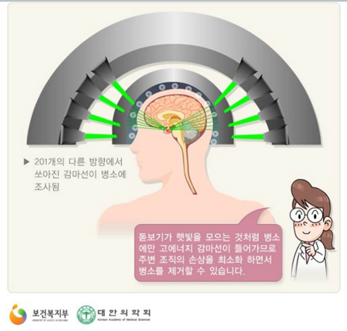 분당서울대병원 감마나이프센터 수술 2000례 달성 전자신문 3451