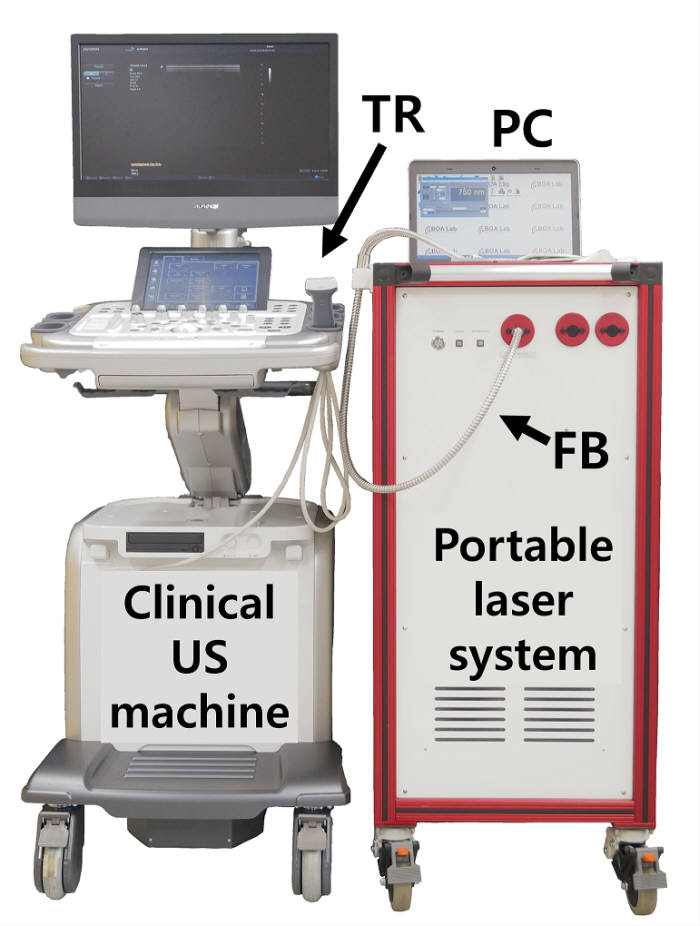 김철홍 교수 연구팀이 개발한 광음향 초음파 영상시스템