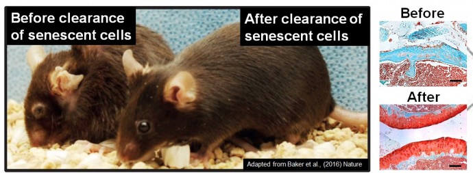 퇴행성관절염에 걸린 쥐(왼쪽)와 신약 후보물질을 투여받은 쥐(오른쪽). 약물 치료 후(아래 사진) 관절의 상태가 치료 전(위 사진)에 비해 건강하다. (출처: UNIST)