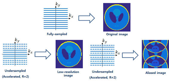 일반적인 MRI 영상 획득, 가속 영상 획득 방식을 설명한 모식도