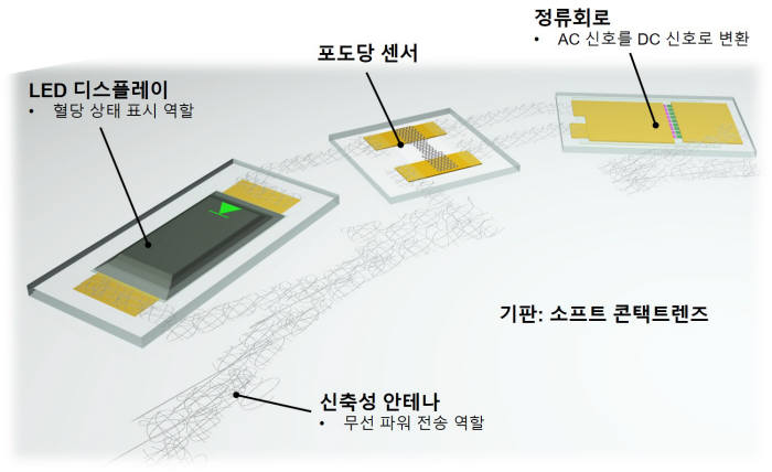 스마트 콘택트렌즈에서 LED로 혈당 상태를 표시하는 원리(고혈당)