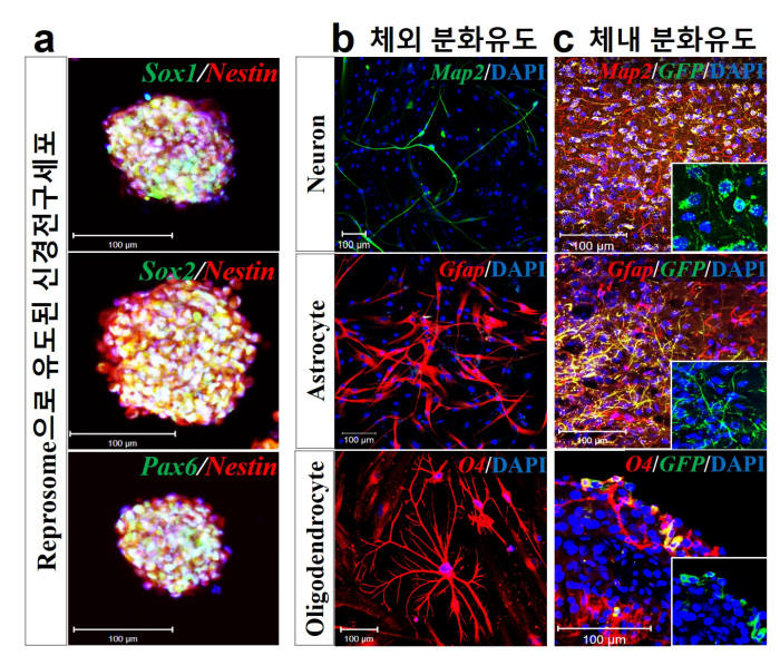 엑소좀으로 고효율 신경전구세포를 직접 교차분화 유도하는 모습