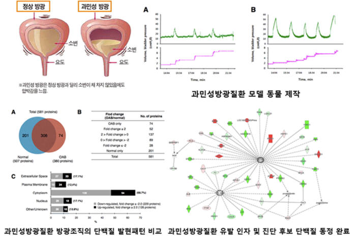 과민성 방광질환 방광조직의 단백질 발현 패턴과 유발인자 및 진단 후보 단백질 동정