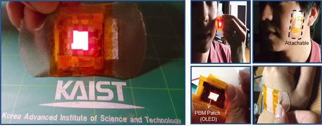 피부에 부착하는 웨어러블 OLED 패치의 구동 모습
