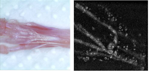마우스 발 부위의 피부를 제거한 후 힘줄 조직의 사진(왼쪽)과 피부 제거 없이 얻은 힘줄 조직의 광음향 영상.