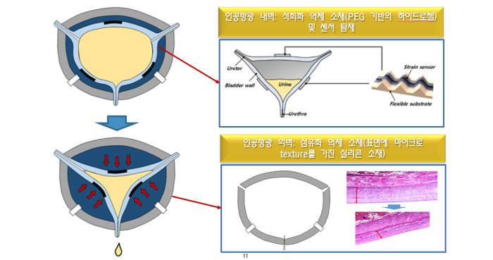 에이치엘메디텍이 개발 예정인 능동형 인공방광 모형