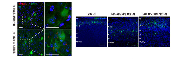 일차섬모 생성을 회복시킨 대뇌 피질 발달 장애 동물 모델에서 신경 세포의 이동이 정상 수준으로 돌아온 모습