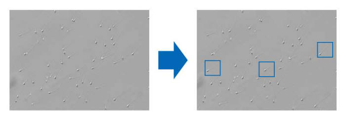 건강한 정자를 인식해 실시간으로 표시하는 정자 선별보조 AI시스템