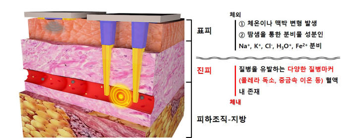 혈액 속 질병 원인 물질 실시간 감지한다