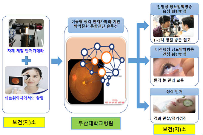 부산 안저카메라 기반 AI 진단서비스 개념도.