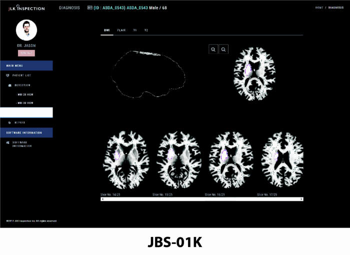 제이엘케이인스펙션 뇌 MRI 정량적 분석 솔루션 jbs-01K 사진출처=제이엘케이인스펙션