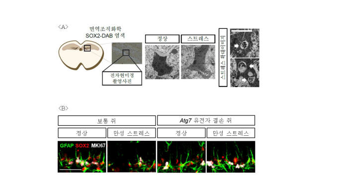 스트레스에 의한 오토파지 유도와 오토파지유전자 억제에 의한 신경줄기세포 보호 관찰결과