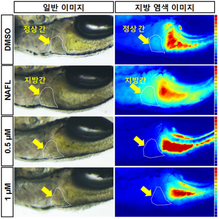 지방간 유발 제브라피시 간(민트색)에 신약후보물질을 투여하자 정상 상태(파랑색)로 회복되는 모습