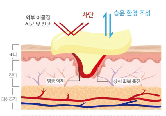 키토 액티베이터는 막 투습성으로 적절한 습윤환경을 조성해 세균과 진균 등 외부 이물질을 차단하는 효과가 있다.