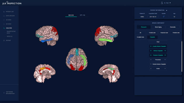 인공지능 기반 건강검진용 뇌 노화 측정 솔루션 에이트로스캔 운용 모습. 사진출처=제이엘케이인스펙션