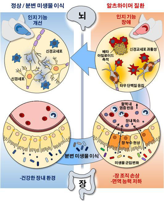 알츠하이머성 치매 쥐의 장내 미생물 군집 변화가 장 점막 면역기능을 약화시키고 장 조직 세포의 퇴화를 유도했다. 이러한 변화로 느슨해진 장 장벽을 통해 혈류로 유입된 장내 독소는 혈액 내 염증성 면역세포를 증가시키고 전신적인 염증반응을 일으켜 뇌 병변을 가속화 시킨다. 정상 쥐의 건강한 분변 미생물 군집을 질환 모델 마우스에 이식함으로써 장내 미생물 군집과 장내 환경에 변화를 유도한 경우, 기억 및 인지 기능 장애가 개선됐다. 베타 아밀로이드와 과인산화된 타우 단백질의 축적, 신경교세포의 과도한 활성을 완화 시킬 수 있음을 확인했다.