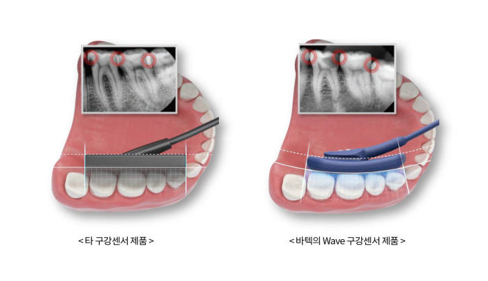 기존 구강센서와 바텍 웨이브 제품 비교