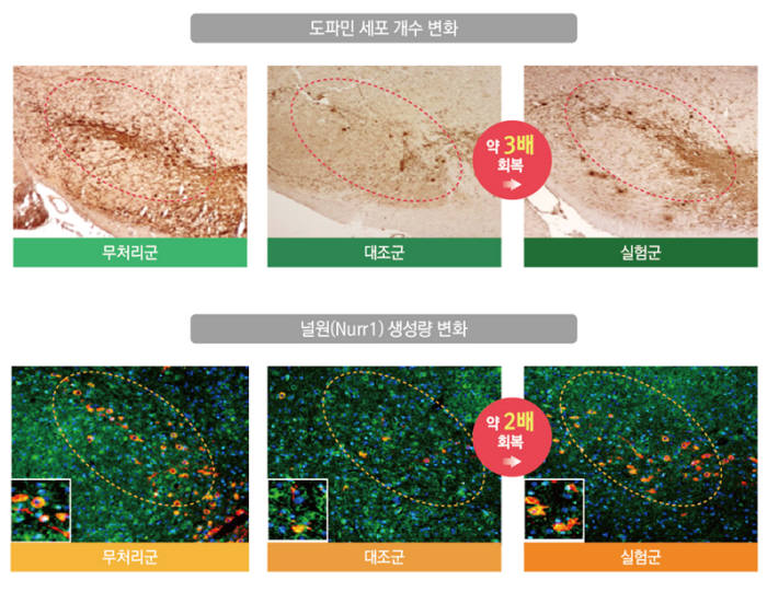 선퇴를 활용한 항파킨슨병 실험 결과