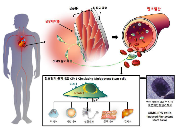 서울대병원, 혈액 10cc 채취만으로 줄기세포 만드는 기술 개발