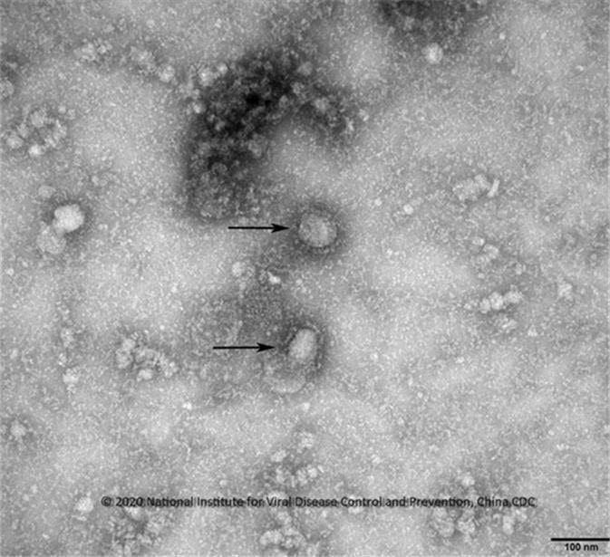 중국 우한 코로나바이러스 전자현미경 사진 (사진=질병관리본부 제공)