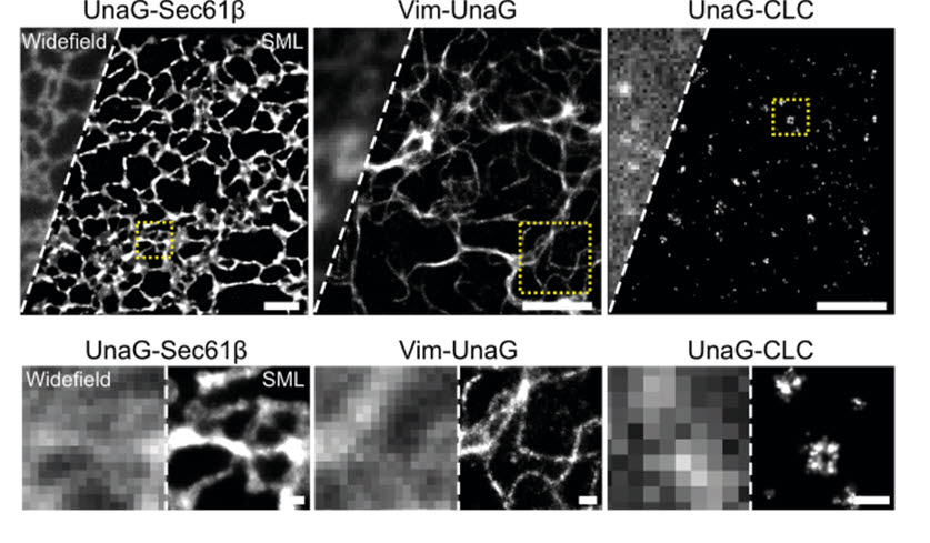 UnaG 형광단백질로 획득한 세포 내 나노구조의 초고해상도 이미지
