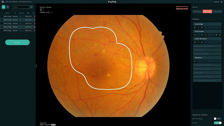 뷰노메드 펀더스 AI 제품 스크린 샷 (사진=뷰노)