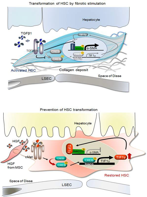 간 손상후 간경변증으로 악화되는 과정에서 새로 발굴한 TIF1 유전자의 역할. (자료=서울대병원) (위)간손상후 섬유화가 악화되는 기전. TGF-SMAD 신호가 발동하면서 간-성상세포에서 TIF1 유전자가 억제되고 섬유화 유전자가 항진돼 간섬유화 초래. (아래)면 간-성상세포에서 TIF1 유전자가 유지되면 TIF1 단백질이 섬유화유전자를 억제하여 간 섬유화를 예방.