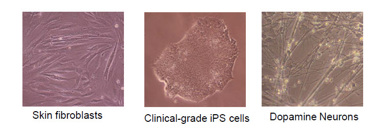 피부세포, 유도만능 줄기세포, 도파민 뉴런의 사진