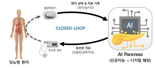 큐어스트림이 세계 최초로 개발중인 AI기반 인공췌장시스템 개념도