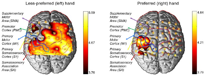 수동 촉각 자극에따른 왼손과 오른손의 대뇌대사활성의 비대칭성을 보여주는뇌 신호 활성화 사진