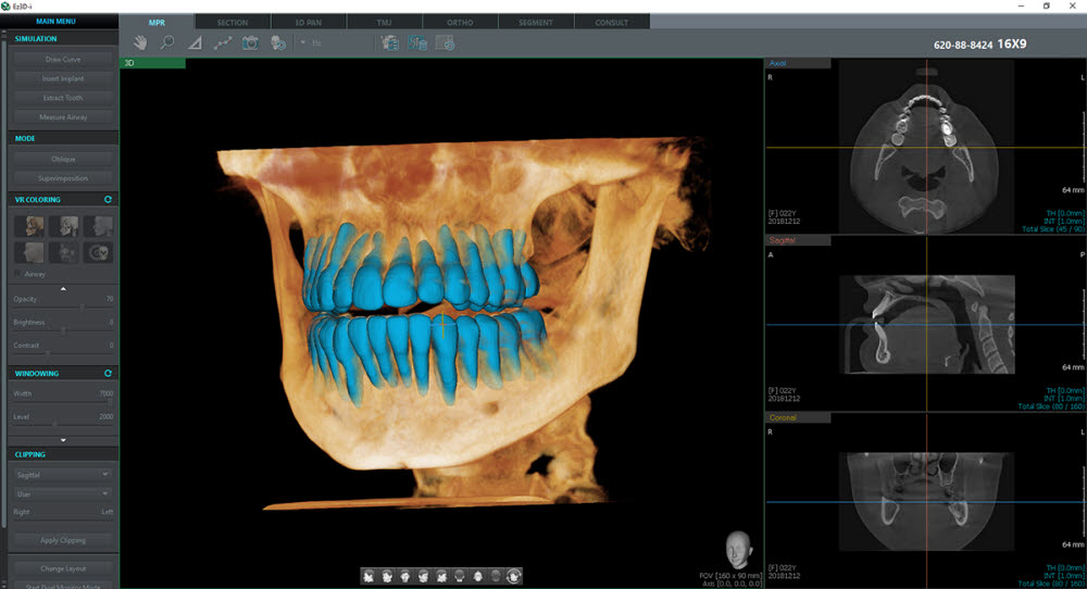 이우소프트, 3D 치아 분리 AI기술 특허·식약처 허가 취득