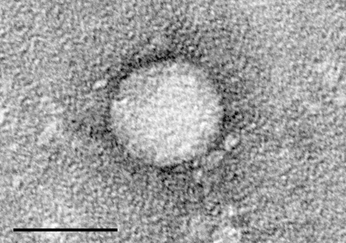 C형 간염 바이러스의 현미경 사진. (출처: wikipedia)