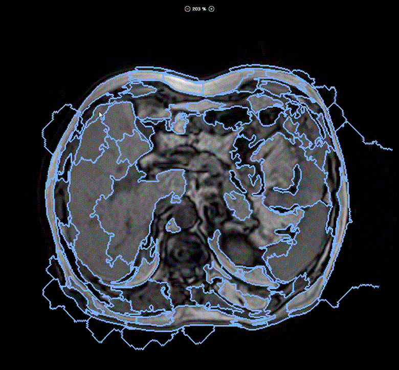 재이랩스가 개발한 메디라벨을 통해 라벨링한 복부 CT 이미지. (사진=재이랩스)