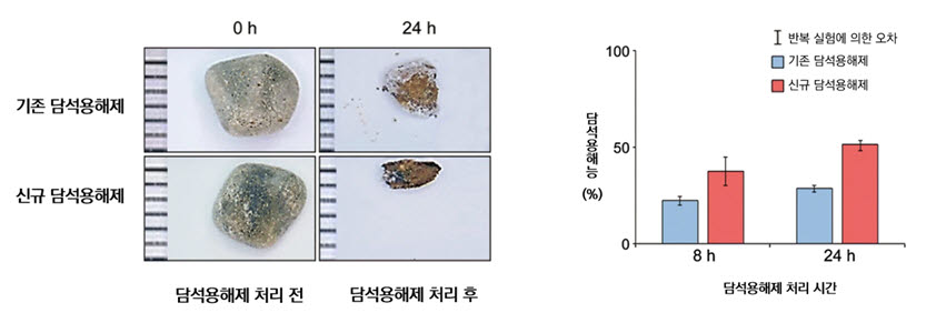 환자에게서 나온 담석을 대상으로 개발 용해제 처리 효과를 확인한 모습