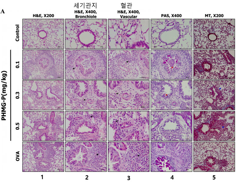 PHMG-p의 기도 내 투여에 의한 폐 조직 병리 사진