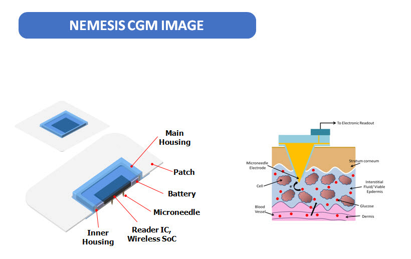 네메시스 연속혈당측정기 개념도