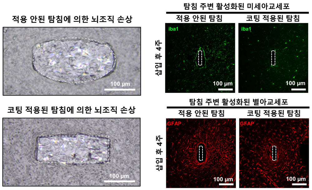 코팅 적용, 비적용 탐침의 뇌조직 손상 및 주변 뇌면역세포 활성도 비교 이미지.