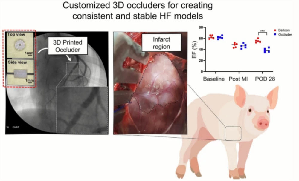 돼지 심근경색 모델 제작용 맞춤형 3D 프린팅 폐색기