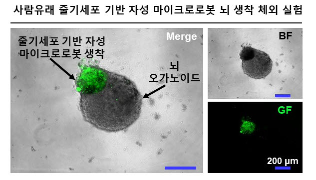 .사람유래 줄기세포 기반자성 마이크로로봇의 배아 쥐 마이크로 뇌오가노이드 생착 체외 실험