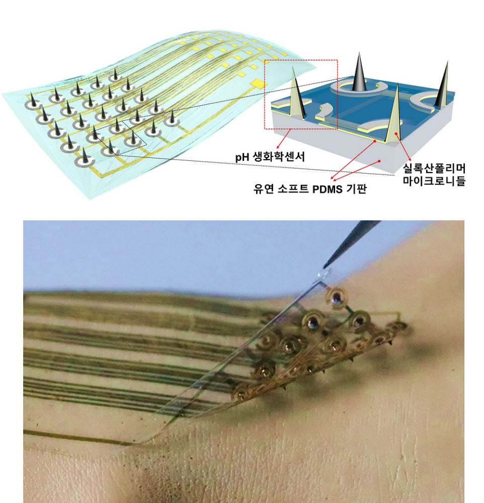 이번 연구로 개발한 플렉서블 마이크로니들 생화학센서. 센서 간격에 맞춰 맞춰 미세바늘들을 배열했다.