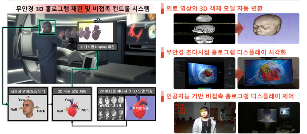 KIST, 이안하이텍과 '메디컬 홀로그램 시스템' 기술이전 및 공동 R&D 계약 체결