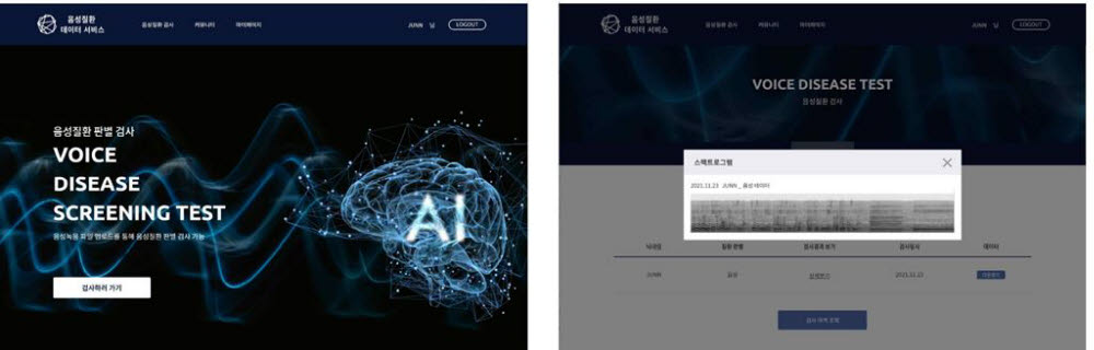 음성질환 데이터 서비스 음성질환 검사 이미지